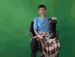 Demi Keluarga, Pak Pardi Tetap Bekerja dengan Kaki Palsu Rusak, BAZNAS Bulukumba Ajak Warga Berdonasi